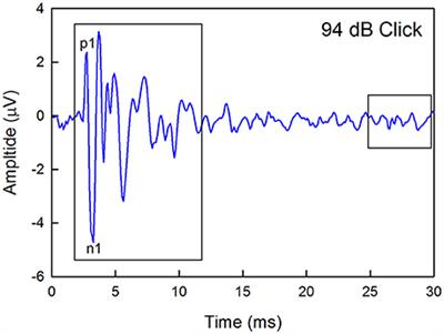 Minimal Effects of Age and Exposure to a Noisy Environment on Hearing in Alpha9 Nicotinic Receptor Knockout Mice